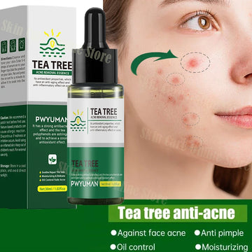 Tea Tree Acne Removal Serum – Pore Minimizing & Skin Repair Formula